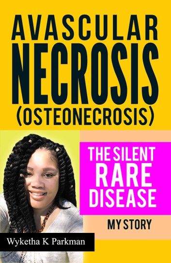Avascular Necrosis (Osteonecrosis): The Silent Rare Disease: My Story