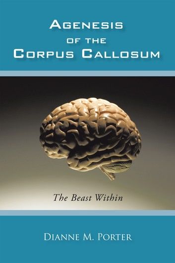 Agenesis of the Corpus Callosum