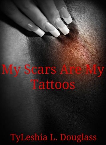 My Scars Are My Tattoos