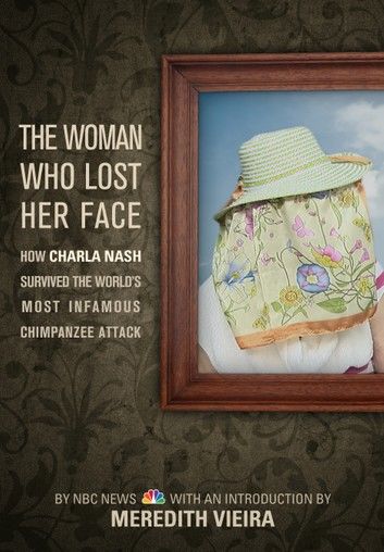 The Woman Who Lost Her Face: How Charla Nash Survived the World\